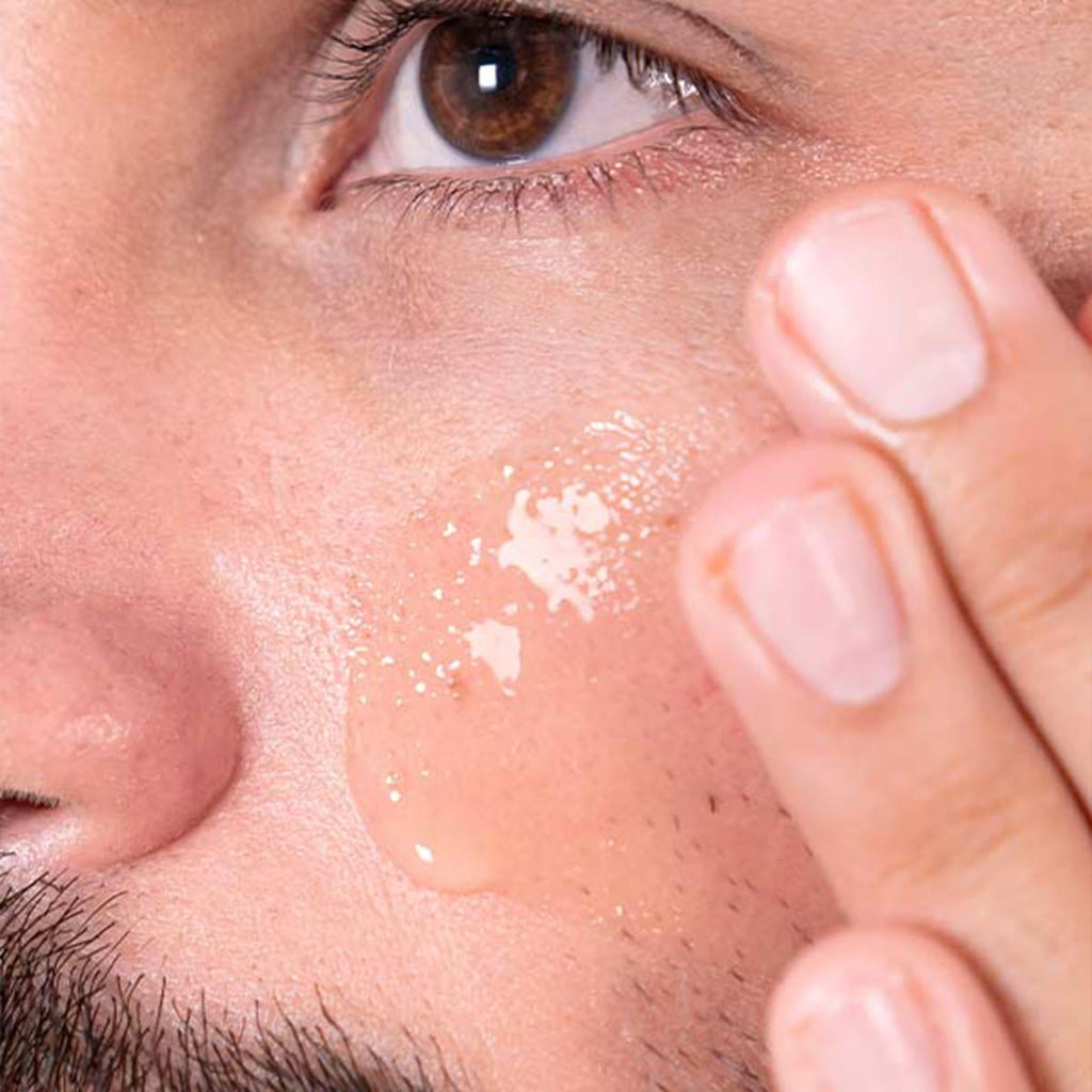 Fix It - Aceite facial para piel grasa o con acné
